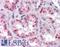 Zinc Finger MYM-Type Containing 4 antibody, LS-B4735, Lifespan Biosciences, Immunohistochemistry paraffin image 