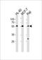 Chromosome 16 Open Reading Frame 71 antibody, PA5-49317, Invitrogen Antibodies, Western Blot image 