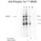 NMDAR2B antibody, XPS-1019, ProSci, Western Blot image 
