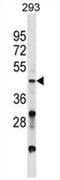 Visual system homeobox 2 antibody, AP54526PU-N, Origene, Western Blot image 