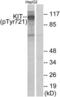 c-Kit antibody, LS-C117404, Lifespan Biosciences, Western Blot image 