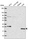Phosphoribosyl Pyrophosphate Synthetase 2 antibody, HPA067599, Atlas Antibodies, Western Blot image 