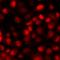 ISL LIM Homeobox 1 antibody, orb412446, Biorbyt, Immunofluorescence image 