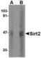 SIR2 antibody, TA306535, Origene, Western Blot image 