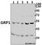 Cytohesin 3 antibody, A11548-1, Boster Biological Technology, Western Blot image 