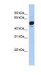 Fibroblast Growth Factor Receptor Substrate 3 antibody, NBP1-52962, Novus Biologicals, Western Blot image 
