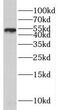 Histone-lysine N-methyltransferase SUV39H2 antibody, FNab08405, FineTest, Western Blot image 