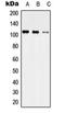 Ubiquitin carboxyl-terminal hydrolase 35 antibody, orb215583, Biorbyt, Western Blot image 