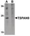 Tetraspanin 9 antibody, PA5-20874, Invitrogen Antibodies, Western Blot image 