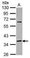 Small Nuclear RNA Activating Complex Polypeptide 2 antibody, GTX117840, GeneTex, Western Blot image 