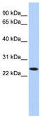 T-cell surface glycoprotein YE1/48 antibody, TA341850, Origene, Western Blot image 