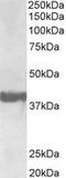 SH3 Domain Containing GRB2 Like 2, Endophilin A1 antibody, MBS423070, MyBioSource, Western Blot image 