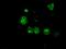 LEM Domain Containing 3 antibody, MA5-25019, Invitrogen Antibodies, Immunocytochemistry image 