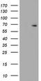 Estrogen Receptor 1 antibody, TA503759, Origene, Western Blot image 