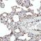 SCARB2 antibody, GTX03182, GeneTex, Immunohistochemistry paraffin image 