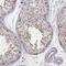 Kidney Associated Antigen 1 antibody, NBP1-87106, Novus Biologicals, Immunohistochemistry paraffin image 