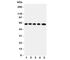 SLC22A5 antibody, R31295, NSJ Bioreagents, Western Blot image 