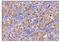 Deoxyhypusine Synthase antibody, A02106-2, Boster Biological Technology, Immunohistochemistry paraffin image 