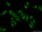 Structural Maintenance Of Chromosomes 3 antibody, 14185-1-AP, Proteintech Group, Immunofluorescence image 