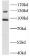Discoidin, CUB and LCCL domain-containing protein 2 antibody, FNab02261, FineTest, Western Blot image 