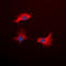Interleukin 13 Receptor Subunit Alpha 1 antibody, LS-C359028, Lifespan Biosciences, Immunofluorescence image 