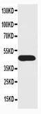 Golgin, RAB6 Interacting antibody, PA1105, Boster Biological Technology, Western Blot image 