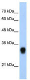 Ribosomal Protein L8 antibody, TA345689, Origene, Western Blot image 