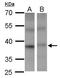 Proline-Serine-Threonine Phosphatase Interacting Protein 2 antibody, GTX108886, GeneTex, Western Blot image 