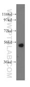 Serine palmitoyltransferase 1 antibody, 15376-1-AP, Proteintech Group, Western Blot image 