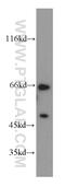 Nuclear Receptor Coactivator 5 antibody, 20175-1-AP, Proteintech Group, Western Blot image 