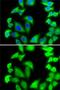 Ribosomal Protein S5 antibody, GTX32851, GeneTex, Immunofluorescence image 