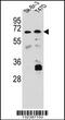 Carboxylesterase 4A antibody, 56-763, ProSci, Western Blot image 
