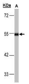 Dihydrolipoamide Dehydrogenase antibody, PA5-27367, Invitrogen Antibodies, Western Blot image 