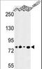 Lysine Acetyltransferase 14 antibody, LS-C167098, Lifespan Biosciences, Western Blot image 
