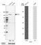 Protein Tyrosine Kinase 7 (Inactive) antibody, HPA003222, Atlas Antibodies, Western Blot image 
