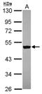 Zinc Finger Protein 584 antibody, NBP2-21029, Novus Biologicals, Western Blot image 
