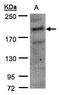 CDC42 Binding Protein Kinase Alpha antibody, LS-C185496, Lifespan Biosciences, Western Blot image 