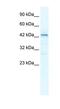 SP140 Nuclear Body Protein Like antibody, NBP1-80140, Novus Biologicals, Western Blot image 