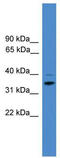 Cyclin H antibody, TA329244, Origene, Western Blot image 