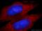 Ro antibody, 19495-1-AP, Proteintech Group, Immunofluorescence image 