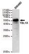 F-box-like/WD repeat-containing protein TBL1X antibody, MA5-24874, Invitrogen Antibodies, Western Blot image 