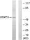 UBX Domain Protein 11 antibody, A30506, Boster Biological Technology, Western Blot image 