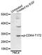 Cyclin Dependent Kinase 4 antibody, AP0593, ABclonal Technology, Western Blot image 