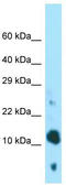 Brain Expressed X-Linked 4 antibody, TA331375, Origene, Western Blot image 