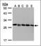 GDP Dissociation Inhibitor 2 antibody, NBP1-52317, Novus Biologicals, Western Blot image 