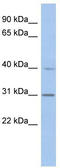 Post-GPI Attachment To Proteins 3 antibody, TA342059, Origene, Western Blot image 