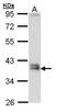 Gamma-Glutamyl Hydrolase antibody, GTX109123, GeneTex, Western Blot image 