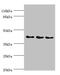 SH3 Domain Containing GRB2 Like 2, Endophilin A1 antibody, LS-C676481, Lifespan Biosciences, Western Blot image 