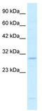 P542 antibody, TA334740, Origene, Western Blot image 