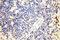 DNA Ligase 1 antibody, 18051-1-AP, Proteintech Group, Immunohistochemistry paraffin image 